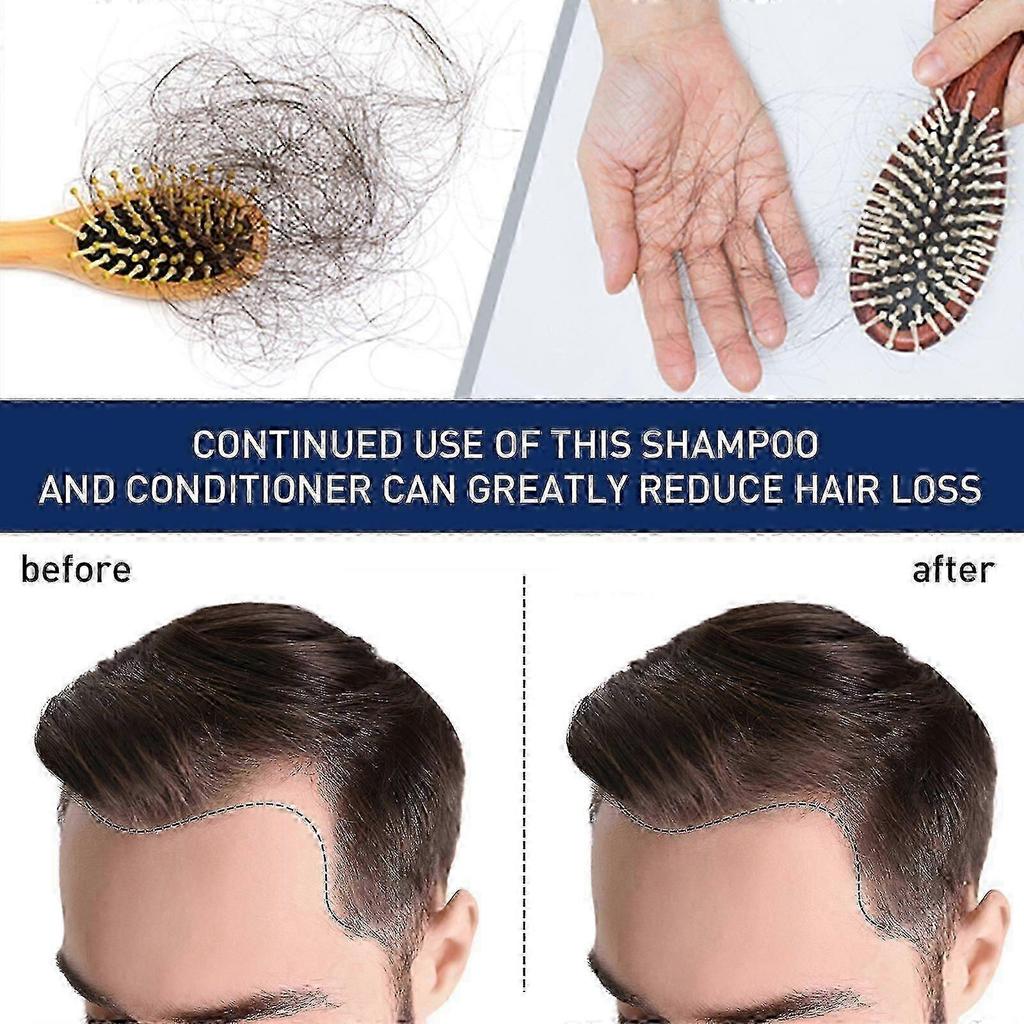 Revitalize Hair Growth Cream with Natural Crocus Sativus, Ginseng & Sophora Extracts Nourishing Scalp Treatment for Thicker, Healthier Hair, Anti-Hai