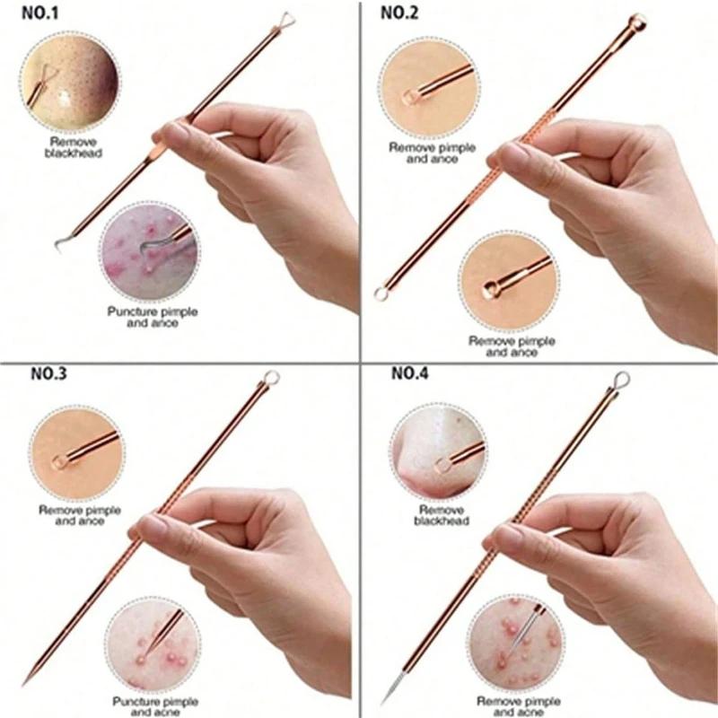 4PCS/set Stainless Steel Rose Gold Acne Needle Double Headed Acne Needle Blackhead Removal and Squeezing Tool