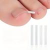 50pcs Ingrown Toenail Correction Tool Ingrown Toe Nail Treatment Elastic Patch Sticker Straightening Clip Brace Pedicure Tool