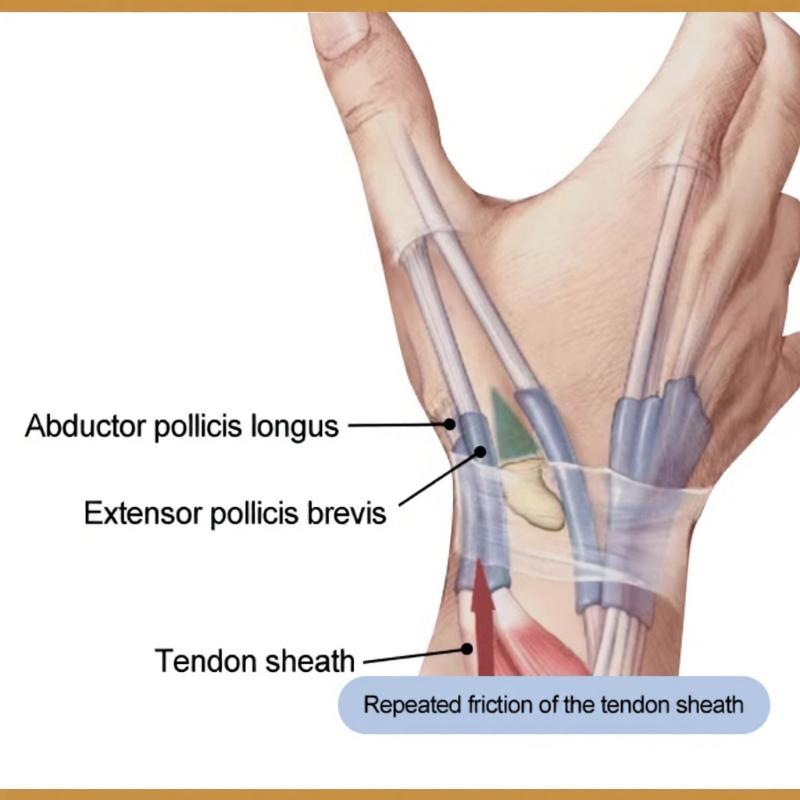 Breathable Wrist Brace with Thumb Support for Arthritis Reduces Finger Pain For a Busy Daily Schedule