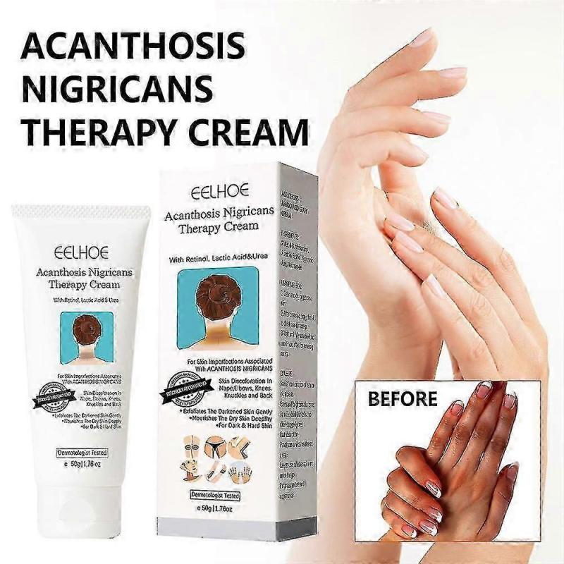 3pcs Acanthosis Cream Nigrifix Cream For Acanthosis Nigricans Black Spot