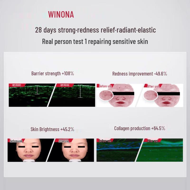 WINONA Soothing and Moisturizing Repair Essence