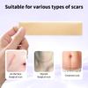 Silicone Scar Patch 50/100/150cm - Waterproof Self-Adhesive Keloid Removal Strip For Surgical Acne Burn