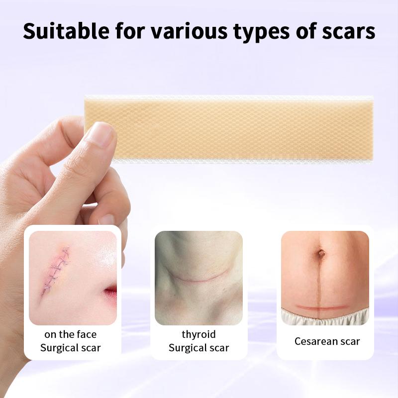 Silicone Scar Patch 50/100/150cm - Waterproof Self-Adhesive Keloid Removal Strip For Surgical Acne Burn