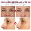 EELHOE Retinol Eye Stick Renewing & Firming Under Eye Balm for Dark Circles, Puffiness, Fine Lines & Wrinkles Travel Essentials for On-the-go Use