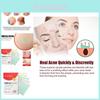 Jaysuing Moon Acne Patch For Effective Spot Treatment Reducing Blemishes And Scars