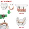 Modello di Impianto Dentale All On 4 Mascella Superiore/Inferiore Modello di Denti Overdenture Dentale Con Impianti Riconfigurabili Rimovibili Per L'Educazione