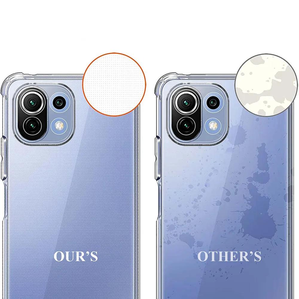 Shockproof Airbag TPU Case for Xiaomi 14T 14 13T Pro 13 Lite 12T 12 12x 11T Protective Cover Capa Fundas Coque