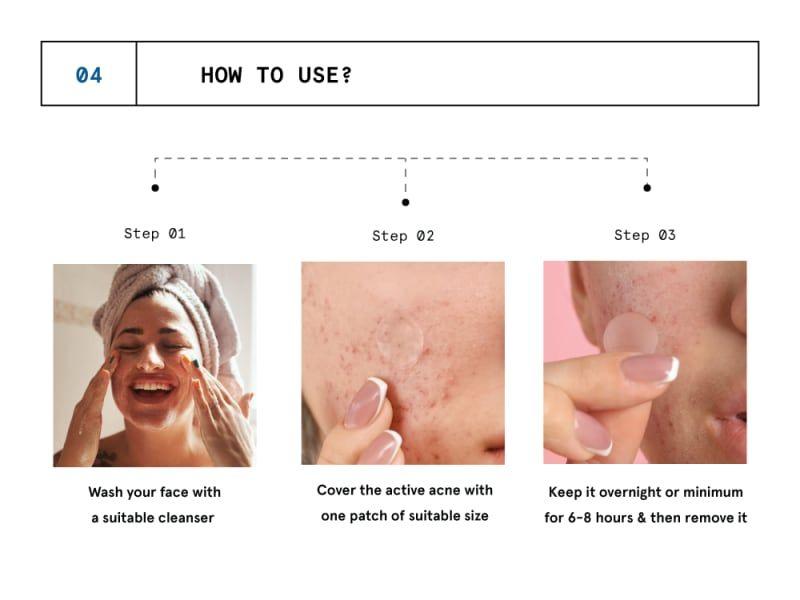 Be Bodywise Hydrocolloid Acne Pimple Patch-Easy and Effective Way To Reduce Acne