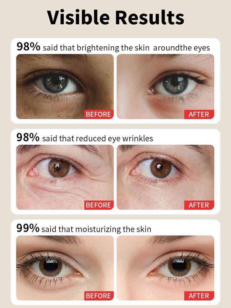 Exclusive Anti-Wrinkle Eye Cream: Firm, Sooth, and Remove Dark Circles & Eye Bags