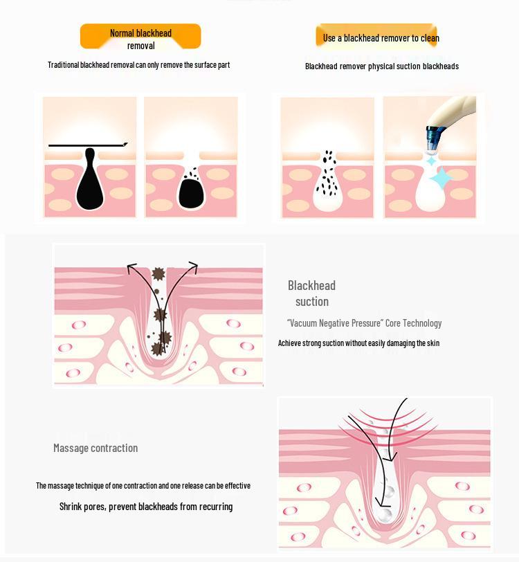 Hot Selling Blackhead Remover Pore Cleaner Beauty Set
