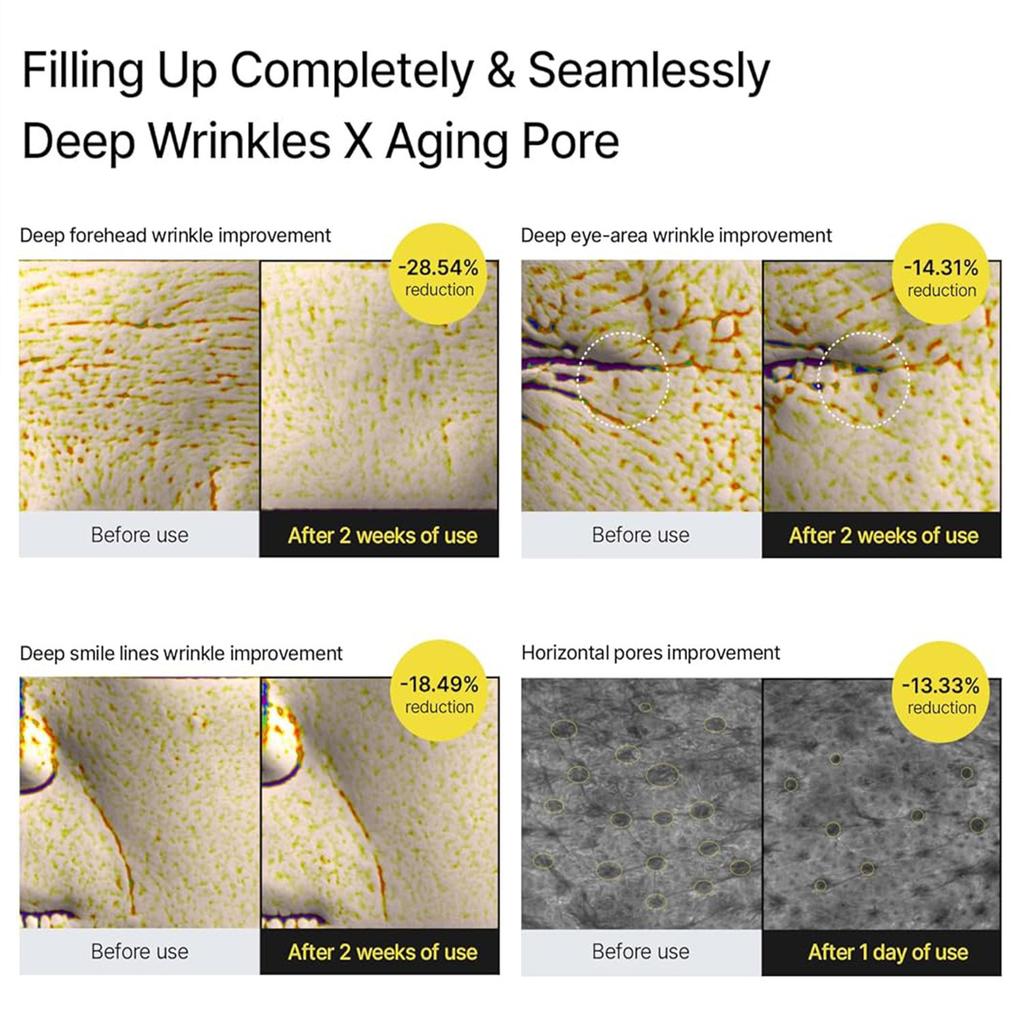 Retinol Eye Cream Tighteness Gentle Rehydrating Tighteness Essence