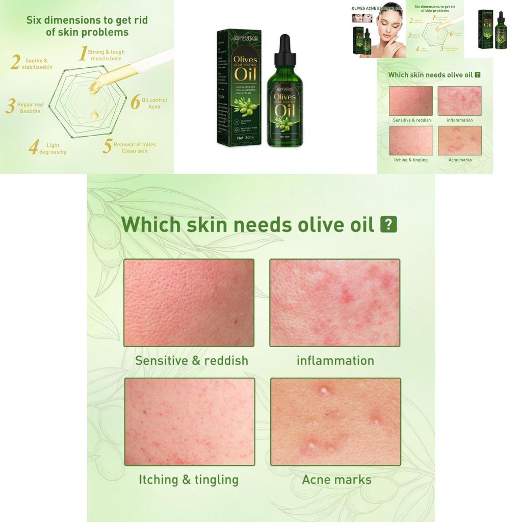 Jaysuing Essential Oil For Gentle Moisturizing And Acne Scar Repair 30ml