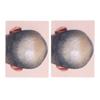 Man Bald Micropigmentattion Practice Skin Silicone Hairline Microblading Practice Pads for Scalp Pra