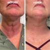 Facial Essence: Lift And Firm Facial Skin, Reduce Fine Lines And Wrinkles, Moisturizing Essence