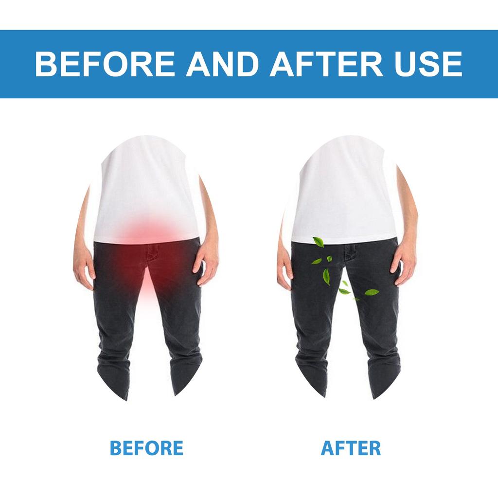 Juckreizlindernde Salbe für Männerhaut bei Ausschlägen und Juckreiz, Feuchtigkeitscreme für trockene Haut, natürlicher Fuß- und Körperbalsam, 30 ml