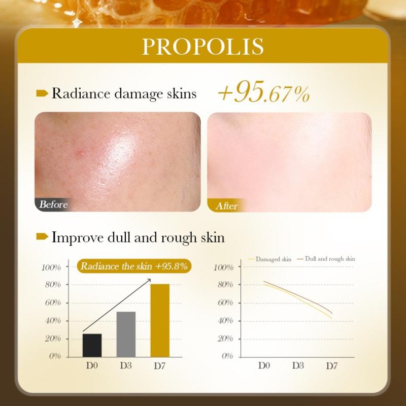 Propolis Serum 30ml Niacinamide Brightening and Moisturizing Serum Skin Care Products