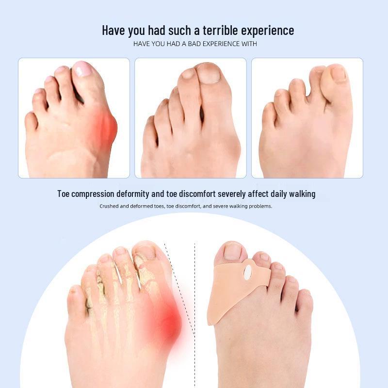 Adjustable Silicone Toe Separator & Protector for Overlapping Toes