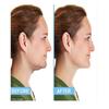 Mini Portable Neck Slimmer Neckline Exerciser Chin Massager