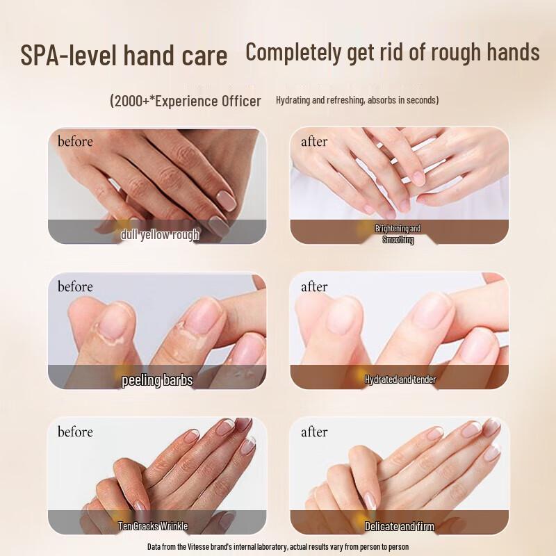 Vitase Whitening & Moisturizing Hand Cream