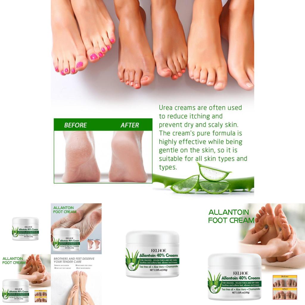 Eelhoe Nourishing Foot Care Cream For Dry Cracked Skin Moisturizing And Hydrating 100g