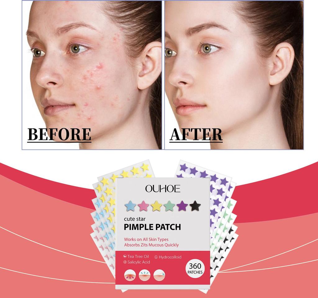 OUHOE Patchs anti-acné en forme d'étoile Hydrocolloïde Couvrance Douce Cache-cernes Autocollants Visage Quotidien pour Hommes Femmes