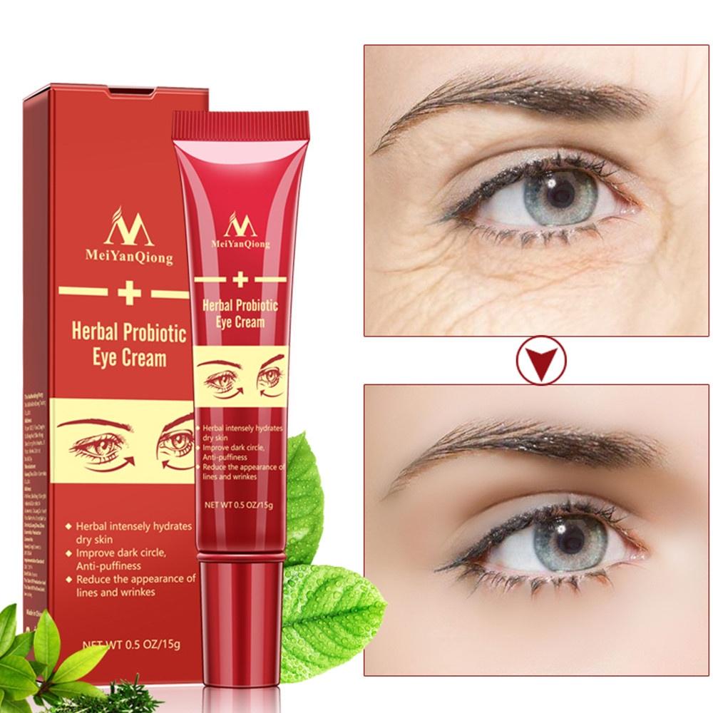 2 Boxes Eye Cream Gel For Dark Circles Puffiness Wrinkles Bags Most Effective Anti-Aging Eye Cream