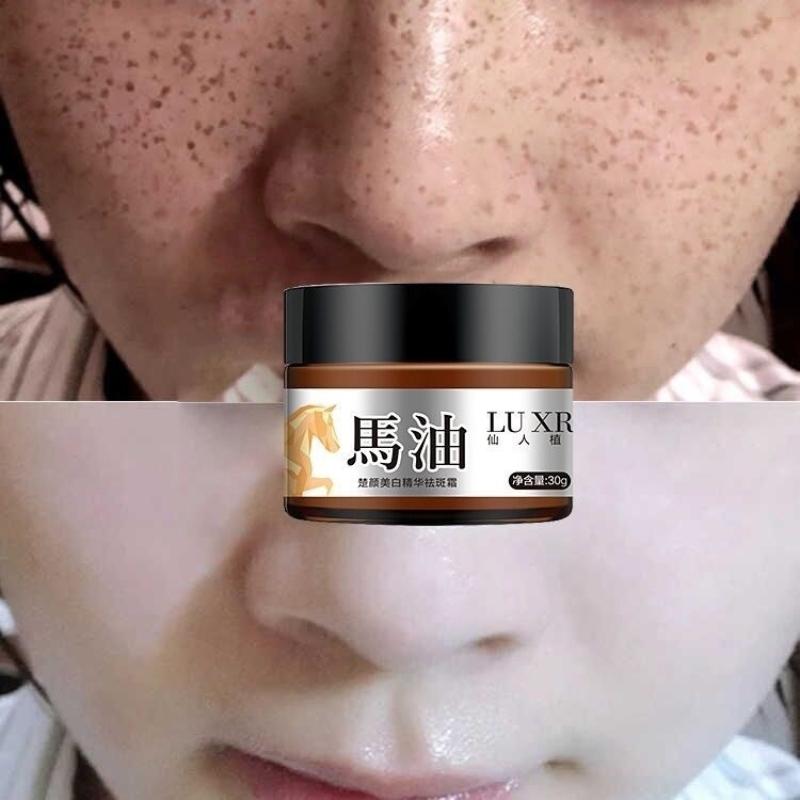 En son at yağı çil kremi, solma, leke, güneş yanığı, kloazma, çiller, yüz bakımı