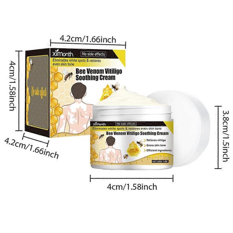 Bee Venom Vitiligo Cream, Natural Anti-Vitiligo Cream for Reduce White Spots & Improve Skin Pigmentation
