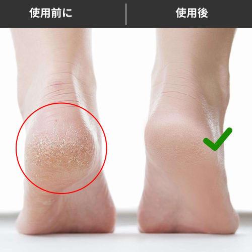 Reusable Foot Polishing Stone, Natural Volcanic Stone, Exfoliating, Cuticle Removal, Foot Polishing Device for Soles and Heels, Pedicure Supplies, Uni