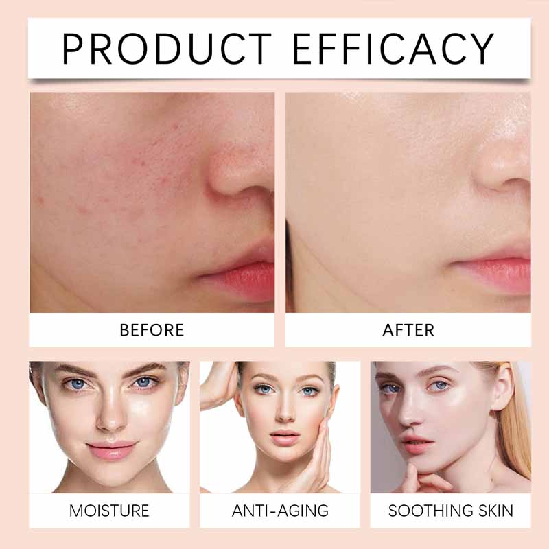 Moisturizing Turmeric Facial Cream Damaged Skin Repair Deep Hydration Nourishing Brightening Face Cream Tender Skin Care Beauty