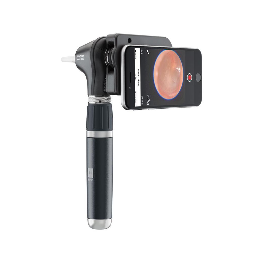 KASHSURG Welch Allyn MacroView Plus Otoscope Head