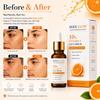 Syenglow 10% Vitamin C Gesichtsserum mit 3% Niacinamid, 1% Kojisäure, für Männer & Frauen, Glow Boost Gesichtsserum Leichte nicht klebrige Formel für