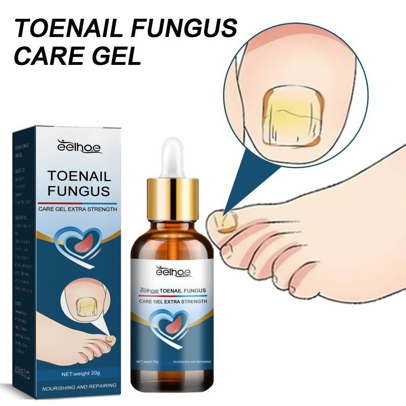Eelhoe Toenail Care Gel For Yellow Thickened Nails With Fortifying And Restorative Formula