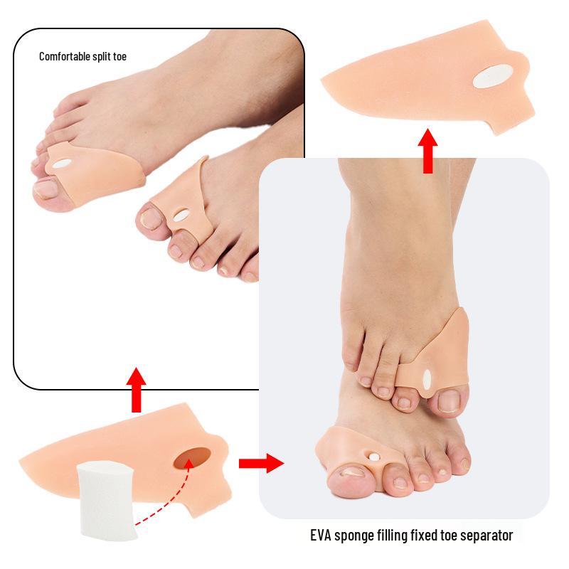 Adjustable Silicone Toe Separator & Protector for Overlapping Toes