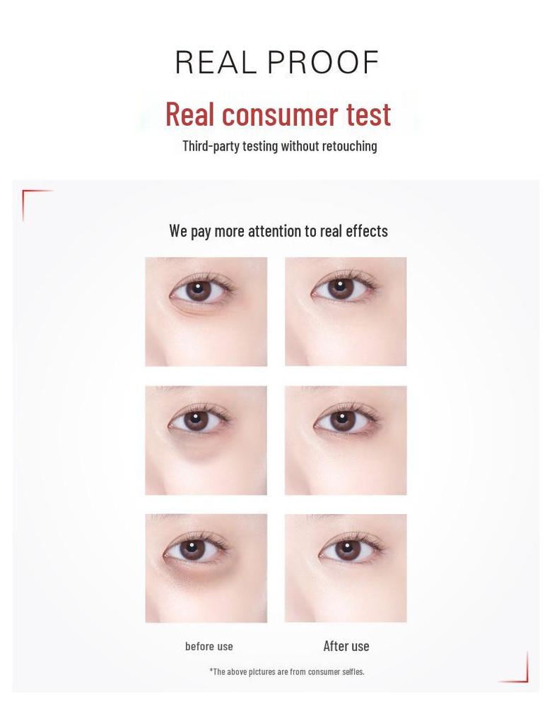 Eye Serum: Reduces Wrinkles, Firms, Moisturizes, Lifts & Tightens for Early Aging and Dark Circles