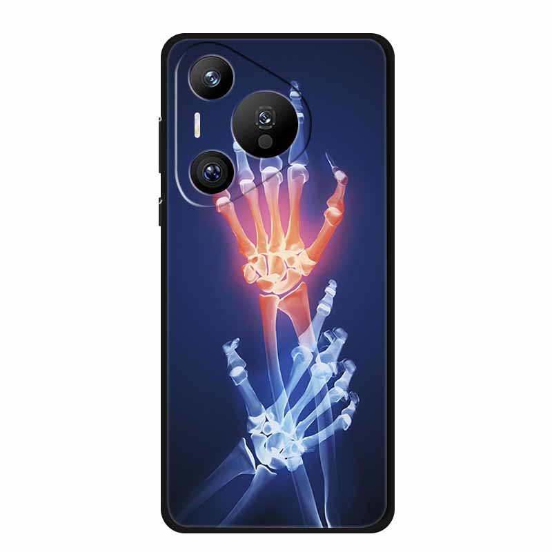 For Honor 400 Pro Case Honor400 Pro Coque Shockproof Black Silicone TPU Soft Back Cover For Honor 400 Pro Phone Cases 400Pro Bag