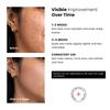 SpotCorrect Siero Viso con Niacinamide al 10% per un Viso Luminoso e Radioso per Tutti i Tipi di Pelle | Con Zinco PCA all'1% | Per Macchie Scure, Iperpigmentazione e Segni dell'Acne