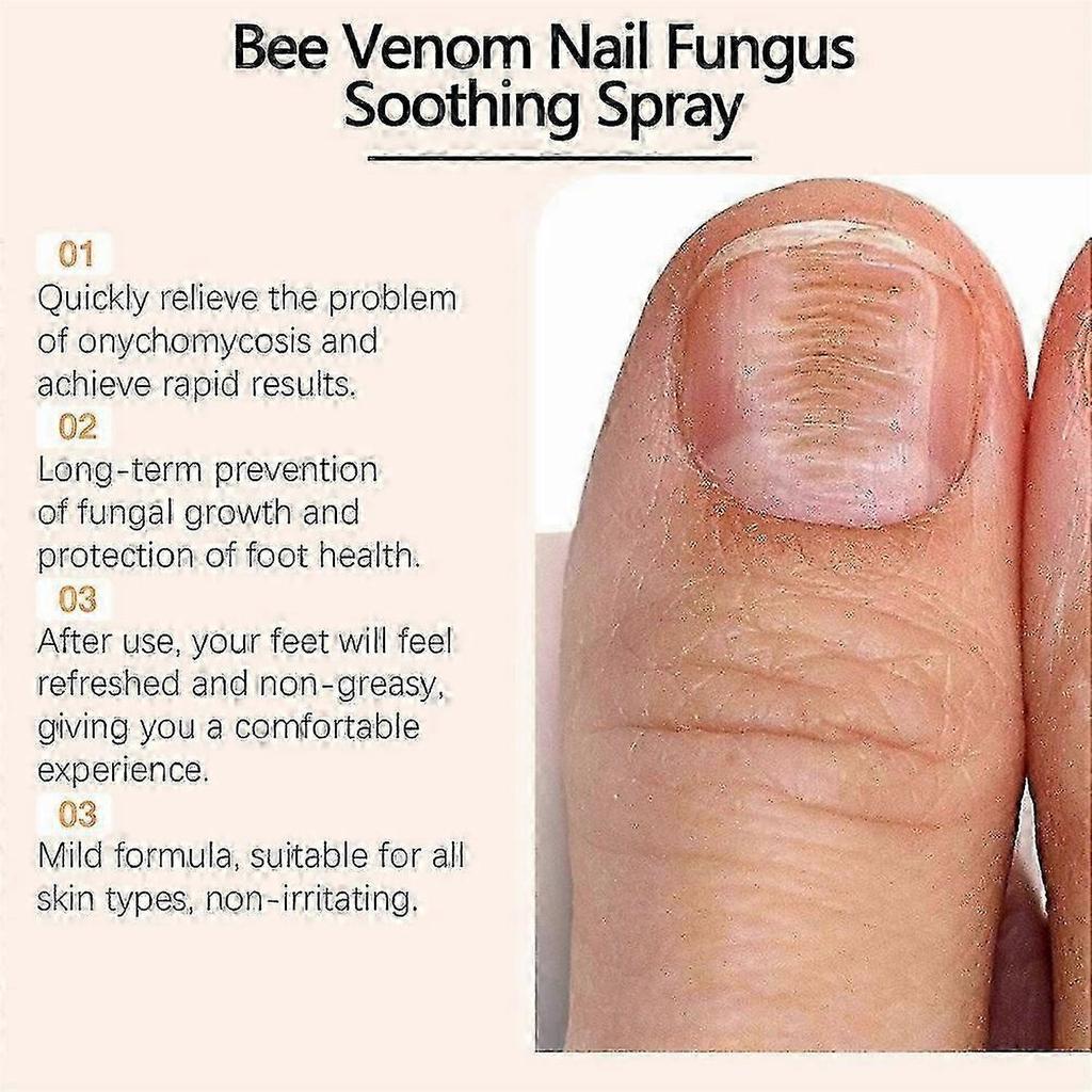 3X Bee Venom Nail Repair Serum, Nail Care Solution, Natural Bee Venom Nail Care Spray, Ingrown Toenail Care Spray