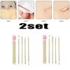 4pc/set Acne Blemish Remover Blackhead Extractor Ultra-fine Beauty Face Pore Cleaner Needles Set Acne Needle Facial Cleaner Skin