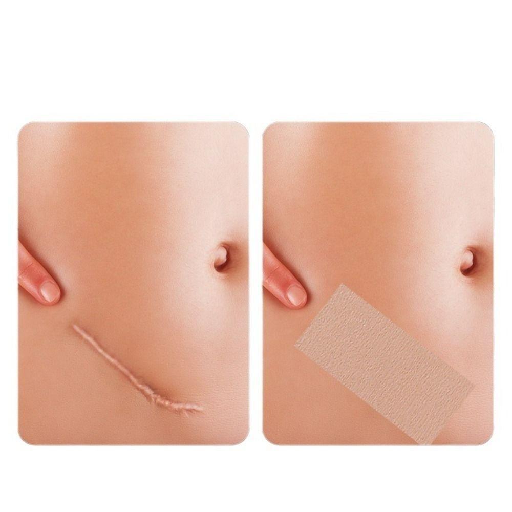 5pcs/set Natural Look Tattoo Concealer Stickers Ultra-thin Black Spot Full Cover  Skin