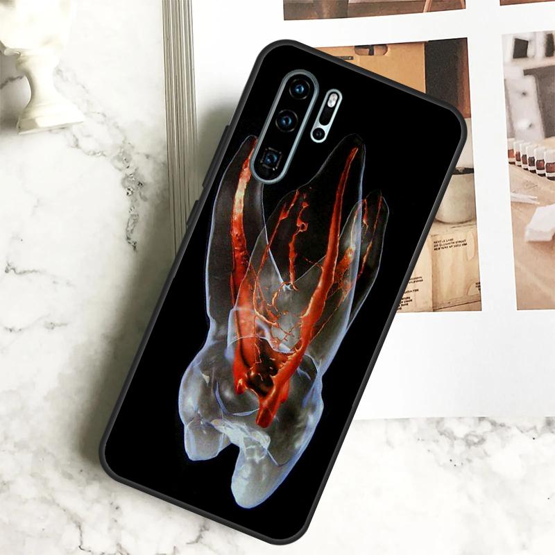 Human Tooth Anatomy For Huawei Nova 7i 8i 11i 12i 12s Y73 Y70 Y90 Y60 Y72 Y61 Y91 9 10 SE P40 Lite P30 Pro Case