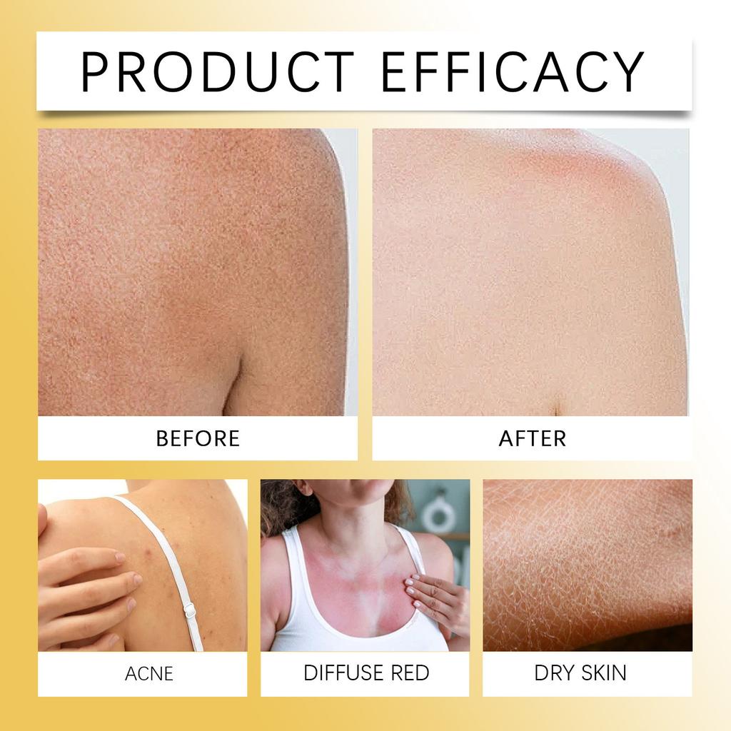 Nutrient E Tělový olej, Tělový hydratační krém, Tělový olej, Hluboce hydratační, Dlouhotrvající hydratace, Zesvětlující tón pleti, Jemná péče, 100 ml