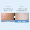 Medikube Zero Pore Toner 250ml Low Irritation Lotion Wipe-off Moisture Hydration Smooth Skin Fluctuation Oily Daily Exfoliation Roughness Sensitive