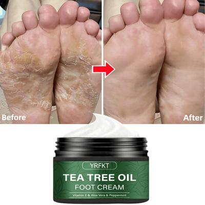 Crema per piedi resistente alle screpolature, crema riparatrice per screpolature ai talloni, rimuove pelle morta e cheratina, ammorbidisce, idrata e leviga la cura della pelle