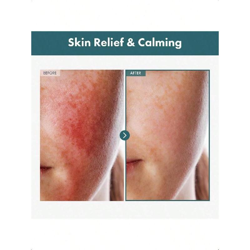Tosowoong Adenosine Cica Cream 100ml | Ultra-High 520,000ppm Centella Asiatica Concentrate, Reduces Redness & Soothes Both Oily And Dry Skin