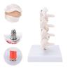 Professional Osteoporosis Model Human Anatomical Spine Model for Teaching Demonstration