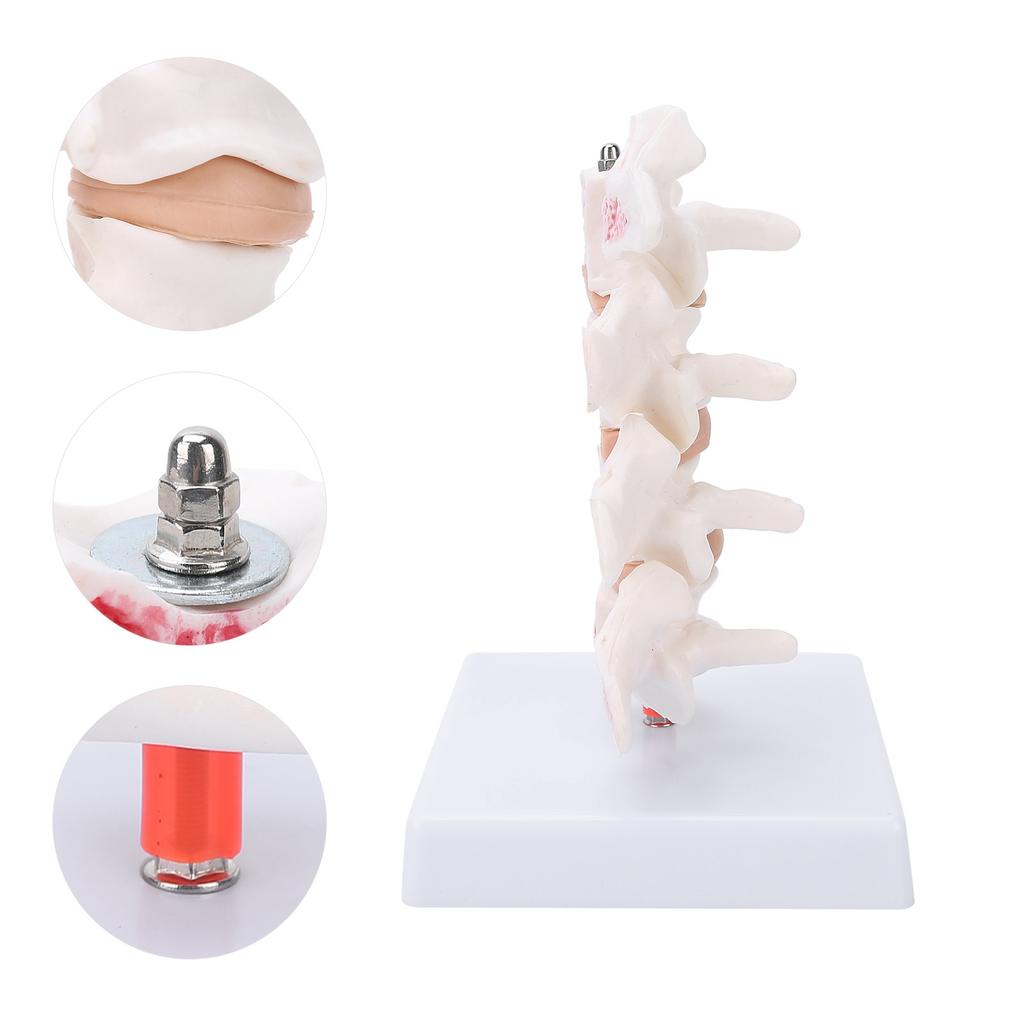 Professional Osteoporosis Model Human Anatomical Spine Model for Teaching Demonstration