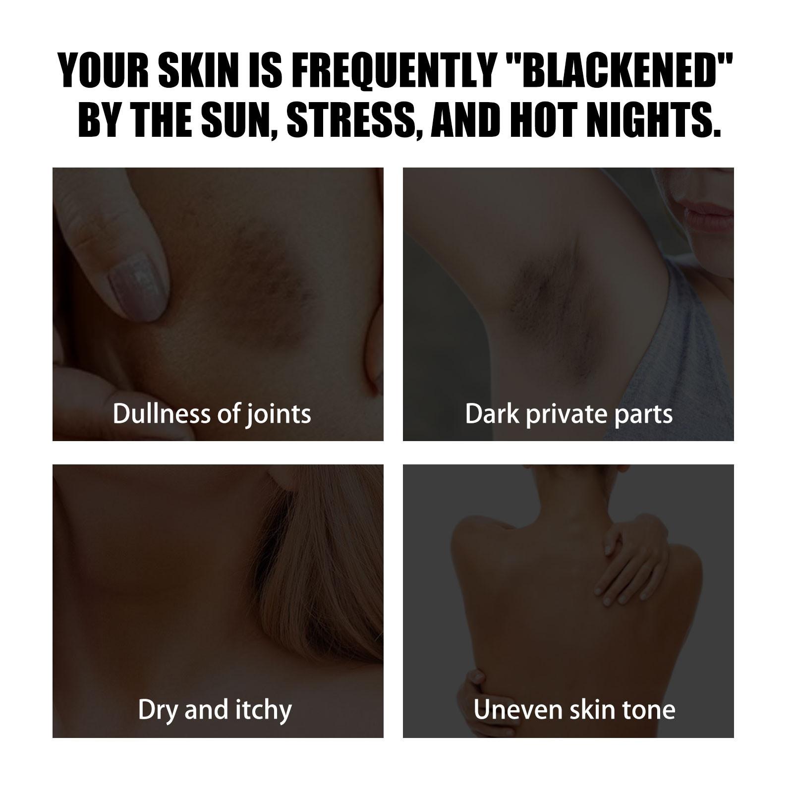 

Отбеливание кожи подмышек, Отбеливание кожи лица и тела, Отбеливание подмышек, шеи, коленей, локтей