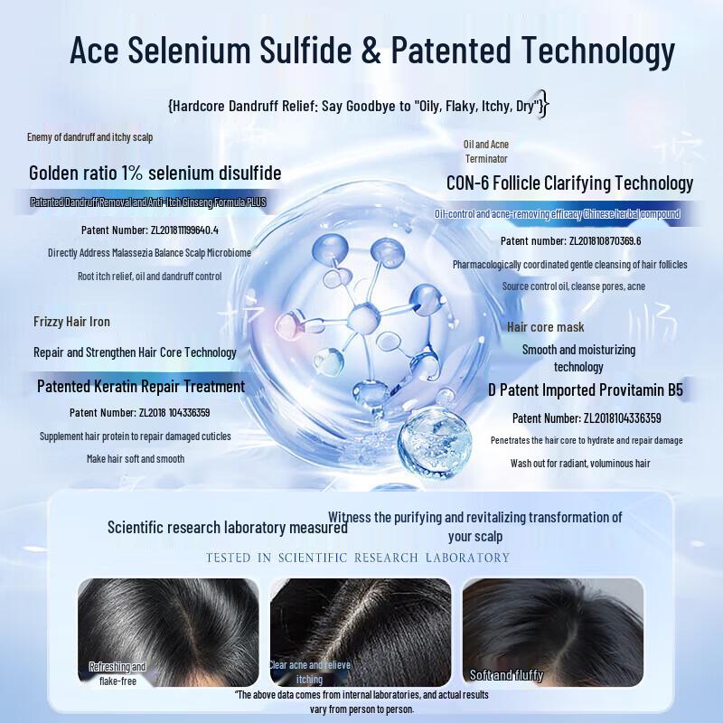 Selenium Sulfide Anti-Dandruff & Oil Control Shampoo